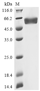 Recombinant Human Oncostatin-M (OSM), partial