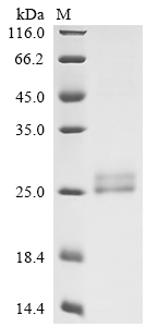 Recombinant Human Lymphotoxin-alpha (LTA), partial, Biotinylated