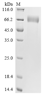 Recombinant Human Interferon gamma receptor 1 (IFNGR1), partial