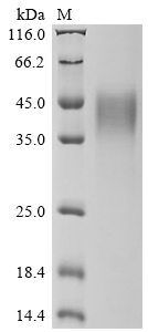 Recombinant Human Interferon gamma receptor 1 (IFNGR1), partial