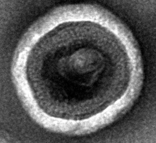 Recombinant Human Claudin-6 (CLDN6), Fluorescent-VLPs (Active)