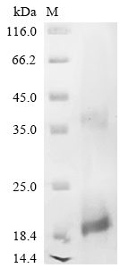 Recombinant Human Slit homolog 3 protein (SLIT3), partial
