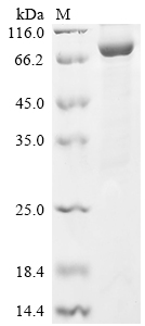 Recombinant Human Prolyl endopeptidase FAP (FAP), partial