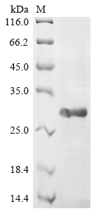 Recombinant Human Vascular endothelial growth factor B (VEGFB), partial