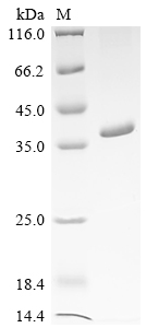 Recombinant Human Interleukin-12 subunit beta (IL12B)