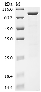 Recombinant Human Receptor-interacting serine/threonine-protein kinase 2 (RIPK2)