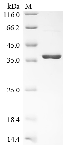 Recombinant Sphingobium sp. Beta-etherase (ligE)