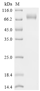 Recombinant Human B-lymphocyte antigen CD19 (CD19), partial, Biotinylated