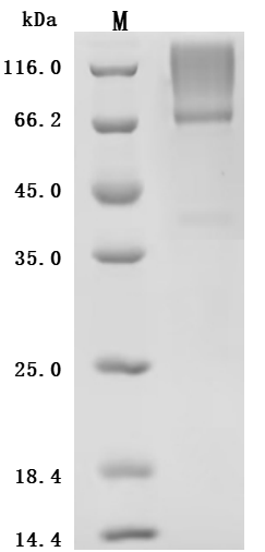 Recombinant Human Glypican-3 (GPC3) (S359F), partial (Active)