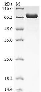 Recombinant Human Endoplasmic reticulum chaperone BiP (HSPA5) (Active)