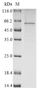 Recombinant Human Leucine-rich glioma-inactivated protein 1 (LGI1)