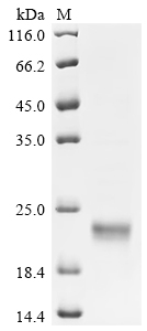 Recombinant Human Sushi, von Willebrand factor type A, EGF and pentraxin domain-containing protein 1 (SVEP1), partial