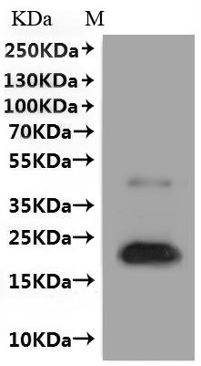 Recombinant Human Claudin-1 (CLDN1)-VLPs (Active)