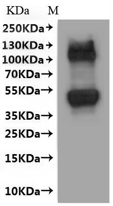 Recombinant Human Large neutral amino acids transporter small subunit 1 (SLC7A5)-VLPs