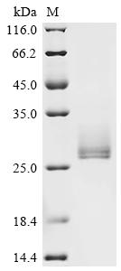 Recombinant Human Interleukin-6 (IL6), Biotinylated
