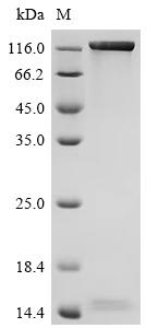 Recombinant Human Receptor-type tyrosine-protein phosphatase delta (PTPRD), partial (Active)