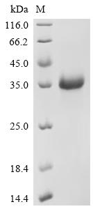 Recombinant Dog Interleukin-2 receptor subunit beta isoform 1 precursor (IL2RB), partial