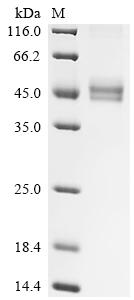 Recombinant Human T-cell surface glycoprotein CD3 gamma chain (CD3G), partial