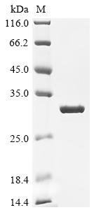 Recombinant Human Carbonic anhydrase 2 (CA2) (Active)