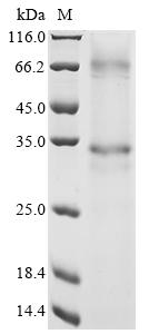 Recombinant Human CAAX prenyl protease 2 (RCE1)