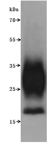 Recombinant Macaca fascicularis Transmembrane 4 L6 family member 1 (TM4SF1)-VLPs (Active)