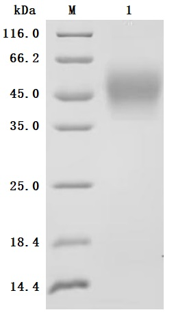 Recombinant Human Interleukin-4 receptor subunit alpha (IL4R), partial, Biotinylated (Active)