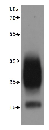 Recombinant Human Transmembrane 4 L6 family member 1 (TM4SF1)-VLPs (Active)