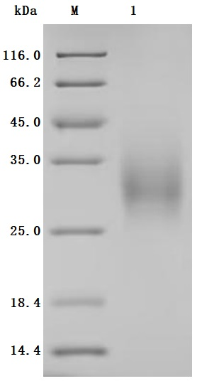 Recombinant Human B- and T-lymphocyte attenuator (BTLA), partial (Active)
