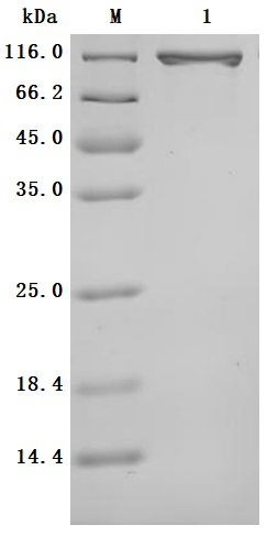 Recombinant Human Serotransferrin (TF) (Active)