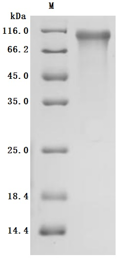 Recombinant Human Cadherin-6(CDH6), partial (Active)