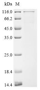 Recombinant Human Ubiquitin carboxyl-terminal hydrolase 1 (USP1)