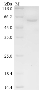 Recombinant Human Leucine-rich repeat LGI family member 4 (LGI4)