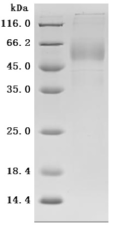 Recombinant Human Killer cell immunoglobulin-like receptor 3DL2 (KIR3DL2), partial (Active)