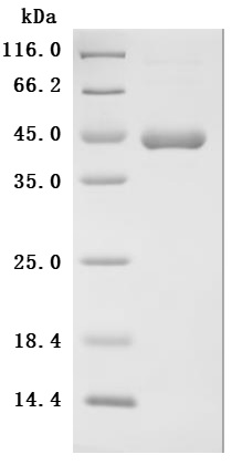 Recombinant Human Interleukin-2 (IL2) (Active)
