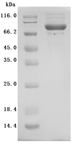 Recombinant Mouse Cytotoxic and regulatory T-cell molecule (Crtam), partial (Active)
