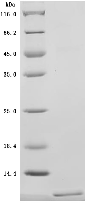 Recombinant Human CD81 antigen (CD81), partial (Active)