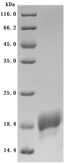 Recombinant Human Serine/threonine-protein kinase receptor R3 (ACVRL1), partial (Active)