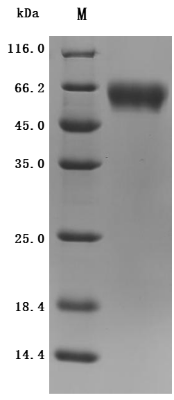 Recombinant Human Interleukin-1 receptor accessory protein (IL1RAP), partial (Active)