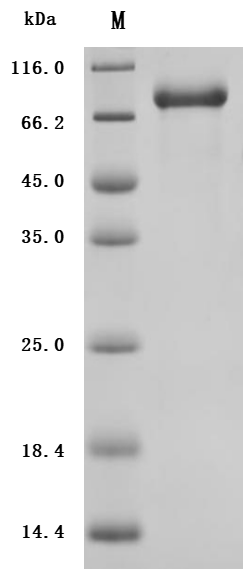 Recombinant Human Interleukin-12 receptor subunit beta-1(IL12RB1), partial (Active)