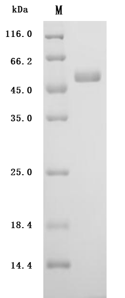 Recombinant Human Urokinase-type plasminogen activator (PLAU) (Active)