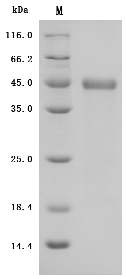 Recombinant Macaca fascicularis Zinc transporter ZIP6 isoform X1(SLC39A6), partial (Active)