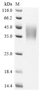 Recombinant Human Low affinity immunoglobulin gamma Fc region receptor III-B (FCGR3B), partial