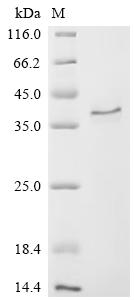 Recombinant Macaca mulatta CCN family member 2 (CCN2) (Active)