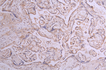 ITGA5 Antibody