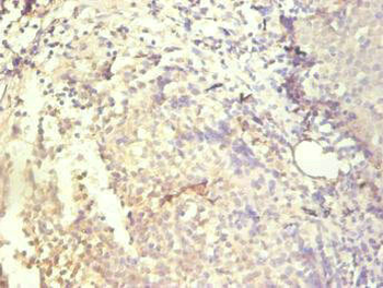 CXCL8 Antibody