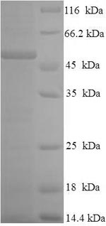 Human CSF2RA protein