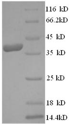 Human Dermcidin protein