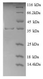 Human GYPA GPA protein