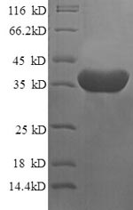 Human ICA1 protein