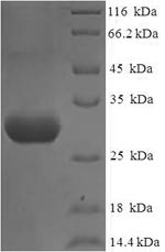 Human NPHS1 protein